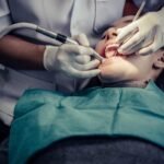 What Is Maxillofacial Surgery