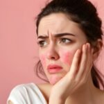 Hormonal Breakouts